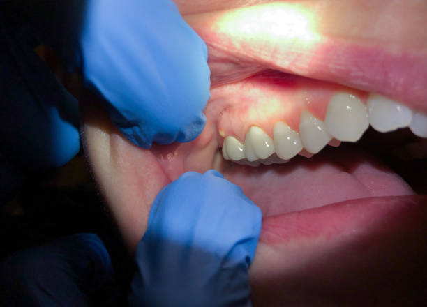 Best Mobile Emergency Dentist in Chesterfield, MO